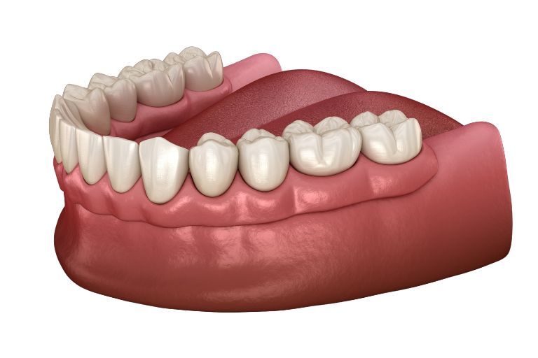 Dentures