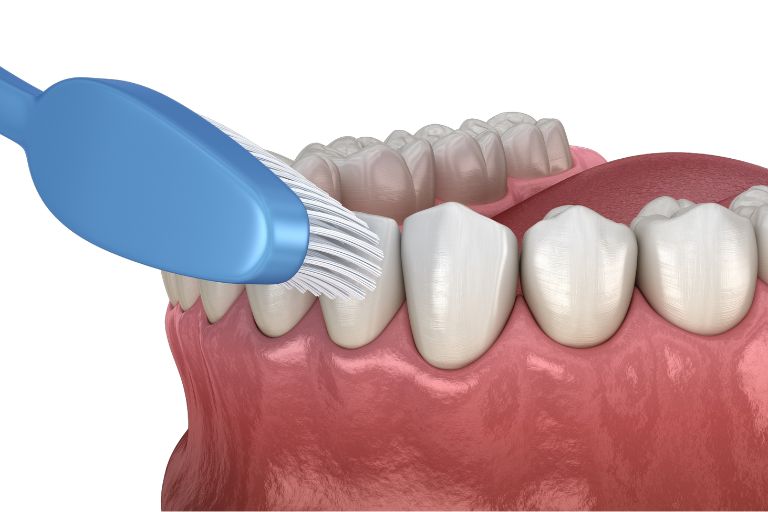 Maintain good oral hygiene with routine cleaning Maintain good oral hygiene with routine cleaning and brushing your teeth